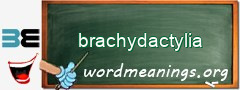 WordMeaning blackboard for brachydactylia